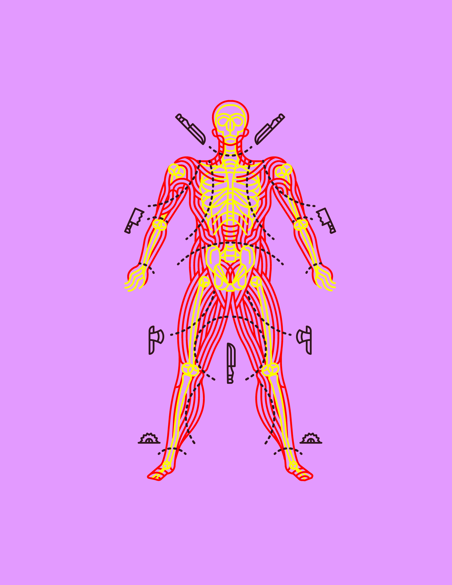 A pound of flesh (The Merchant of Venice)