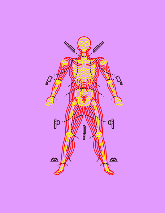 A pound of flesh (The Merchant of Venice)
